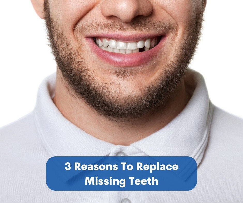 3 Reasons To Replace Missing Teeth